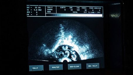 Ultrasound scan of pregnant ewe at the Blenheim Estate